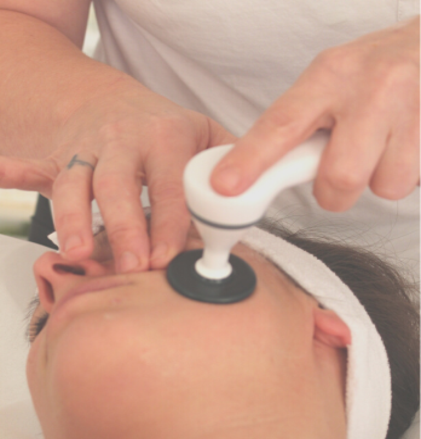 Rejuvenecimiento Facial